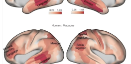 Here’s a visual tour of what makes the human brain distinct from our ape relatives
